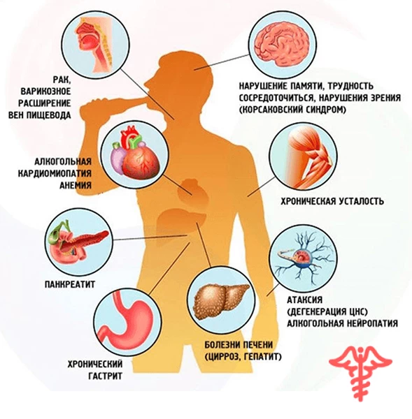 Схема вляние алкоголя на организм